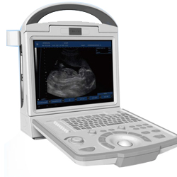 Ultrasonic Diagonstic System